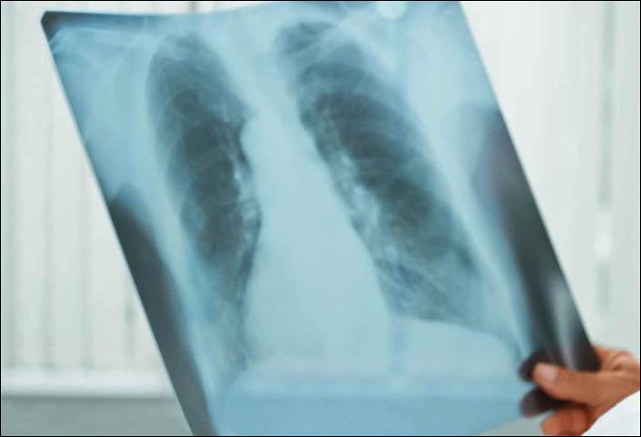 В Пильнинском районе было выявлено семь человек больных туберкулезом