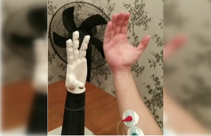Нижегородская студентка создала бионический протез человеческой руки на 3D-принтере