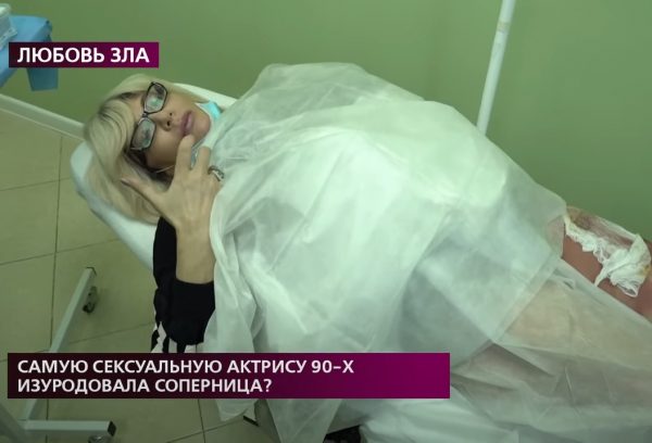 >«Она облила меня кислотой»: нижегородская актриса Наталья Лапина рассказала о нападении