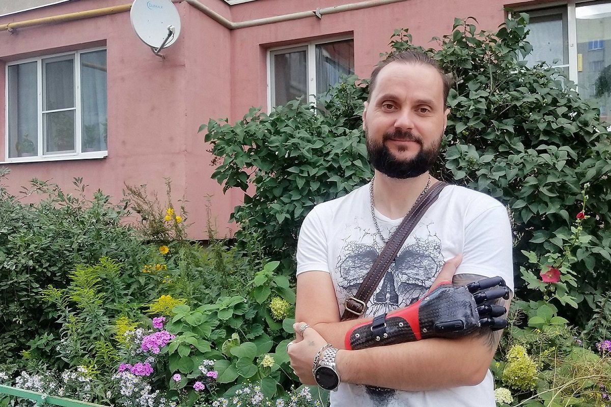 Житель Выксы рассказал о своей жизни с бионической рукой за 5 млн рублей