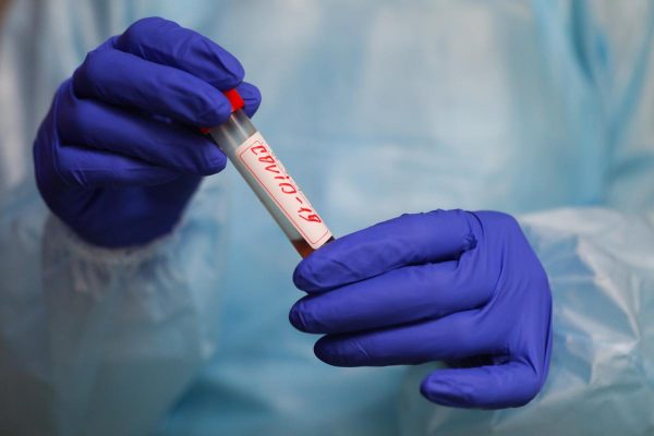 Вирусолог оценил новый способ заражения коронавирусом, открытый американскими учеными