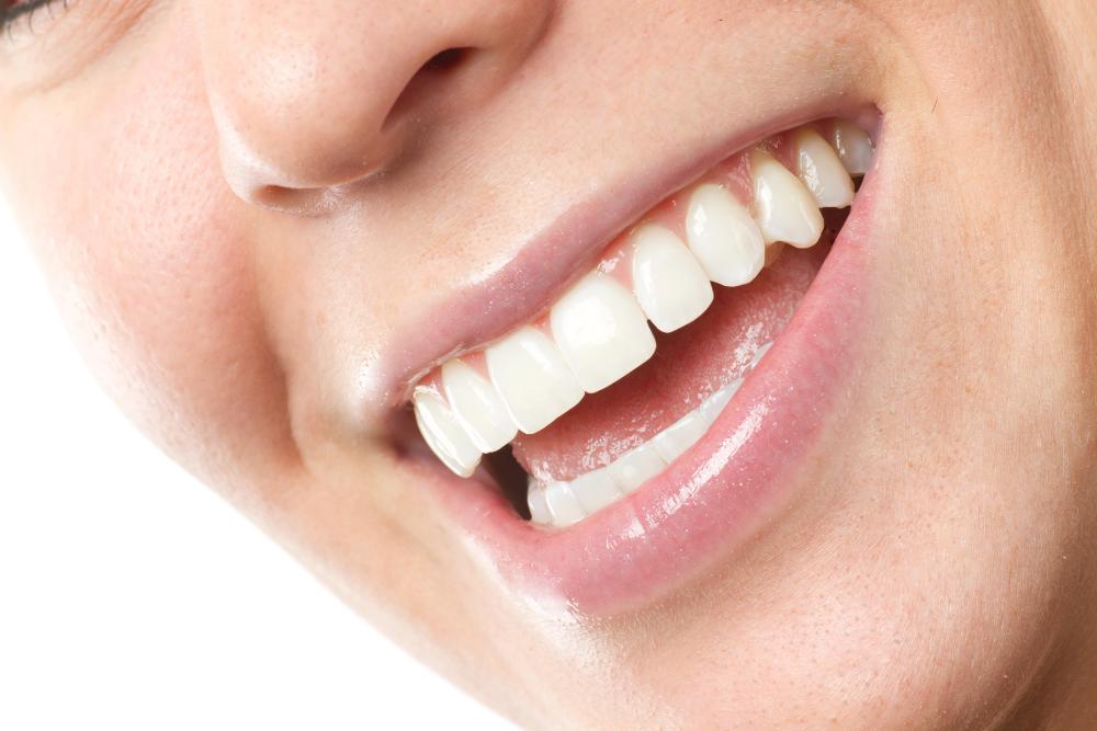 Зубные коронки: виды, материалы, преимущества и недостатки
