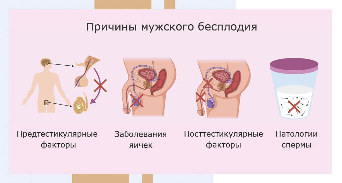 Лечение мужского бесплодия в клинике ЭКО в Москве