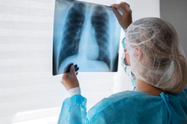 Наследственные заболевания лёгких: новые методы диагностики и лечения