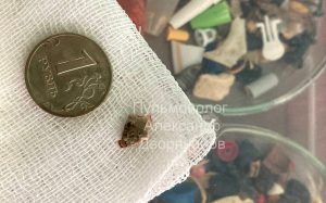 Нижегородские врачи вытащили кость из дыхательных путей 1,5‑годовалого малыша