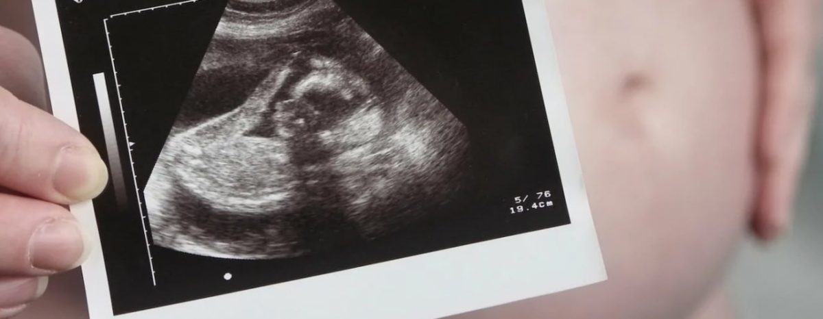 В Нижнем Новгороде женщина стала мамой, несмотря на почти отсутствие яичников