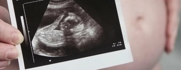 В Нижнем Новгороде женщина стала мамой, несмотря на почти отсутствие яичников