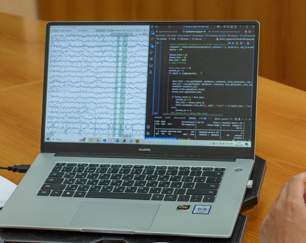 Нижегородские ученые обучили модель определять эпилепсию по активности мозга