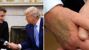 Пожилого нижегородца положили в больницу с «синдромом Дональда Трампа»