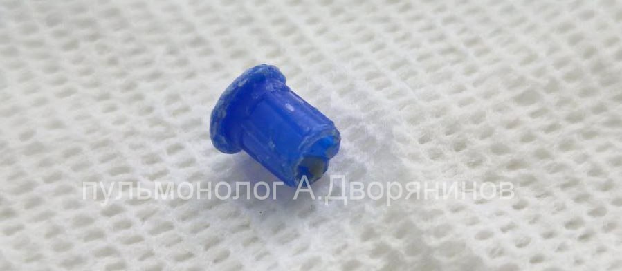 Колпачок ручки достали врачи из лёгких нижегородского подростка