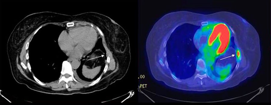 Почти 6 тысяч процедур ПЭТ-КТ прошли нижегородцы с начала года