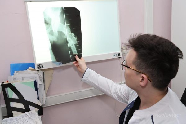 Нижегородцам объяснили, как переломы маскируются под&nbsp;ушибы